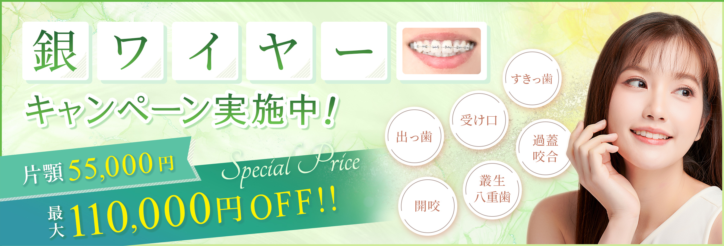 銀ワイヤーキャンペーン